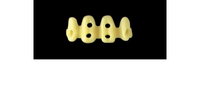 Cod.E17 f Upper Anterior: 10x  hollow pontics blocks-frames, (12-22), carved to fit into wax veneers Cod.E17Upper Anterior, X-LARGE, (12-22), for porcelain pressed to metal bridgework